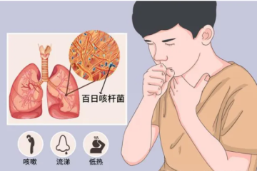 百日咳的小科普